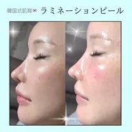 韓国肌管理🇰🇷ラミピール🌼