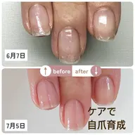 自爪育成ネイルケア お試しメニュー＼爪を噛む•爪の縦線•爪が小さい•美縦爪へお悩み改善／