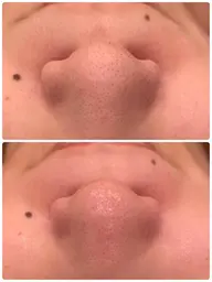 大人気！フェイシャルWAX【WAXXXX】