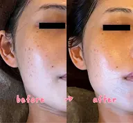 【ハーブピーリングリピーター専用】デコルテマッサージオプション30分※こちらのメニューのみでのご予約は承っておりません。