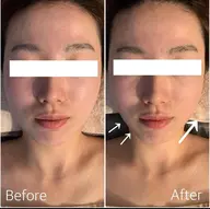 【頭脳美クレンズ小顔調整】脳脊髄液に着目した小顔調整