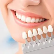 セルフホワイトニング