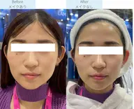 根本から元気にして揺るがない肌を導く最新フェイシャル💖長年のお悩みにも◎くすみ、シミ、毛穴、たるみ