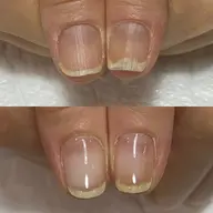 【初回カウンセリング無料】剥離爪ハンドケア