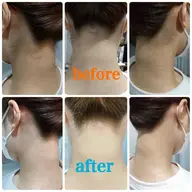 【うなじ】ワックス脱毛 アップヘアにする方必見!気分スッキリ爽快🌸メンズOK