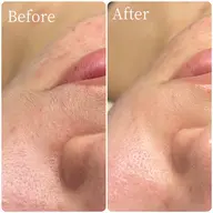 【🪞全顔フェイスワックス➕モデリングパック付き🪞】肌鎮静🌿産毛ゼロの艶肌✨💆🏼♀️