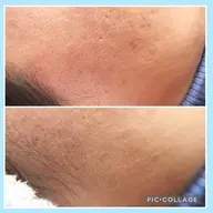 🥝フェイシャルワックス