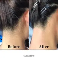 フェイシャルWax脱毛+うなじWax脱毛🧡夏に向けてムダ毛ケア✨✨