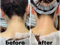 【女性】圧倒的仕上がり◎首元美人＊まとめ髪も◎【うなじMIX脱毛】　￥4400