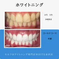 【冬のお試しキャンペーン】まずはお試し♪ホワイトニング12×2回　¥4,980→¥1,980