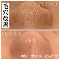 30分クイックフェイシャル！毛穴改善アンケートモニター募集👃