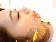 【初回】スタンダード美容鍼（カウンセリング込）