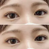 ラッシュリフト