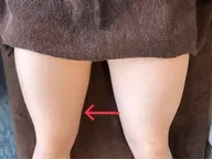 【太もも痩身】なかなか落ちない太ももをスッキリシャープに！一度で効果的面！国内最高級マシン使用で安心安全に部分ダイエット