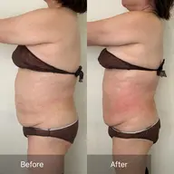 初回最強痩身レモン🍋10cc