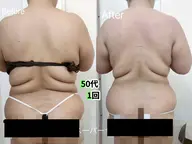 当日限定【痩身モニター募集】脂肪・セルをほぐし!全身痩身120分 ¥28,800