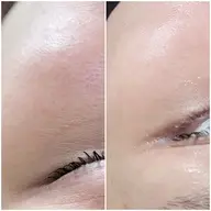 1回でも実感♪美肌フェイスワックス