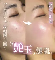 【乾燥／カサつき】粉ふき知らずのしっとり肌へ✨️¥11,000→¥5,500