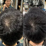 メンズカット➕アズフレイヤ製　純度100%エクソソームで育毛