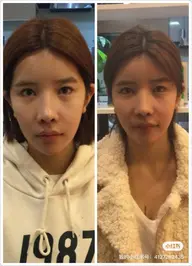 【左右差改善◎】小顔矯正(コルギ)40分 ¥11800→5880