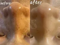 1日1枠【男性はこちら】毛穴の黒ずみ大掃除★メンズ毛穴洗浄フルコース 新規¥10,560 →再来12,660円