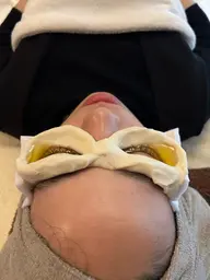 👀眼精疲労撃退コース👀ネトラバスティ＋目の周り美容鍼（電気通電有り）or炭酸ヘッドマッサージ