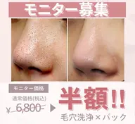 ＼モニター募集／先着10名様限定！毛穴の黒ずみオフ👃🏽つるすべコース半額で施術可能！