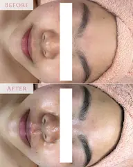 4/1空き◎【ミニモ限定価格❤️‍🔥】プレミアム艶肌Wax✨毛穴洗浄＋ワックスでツヤ肌へ導く極上ケア☆