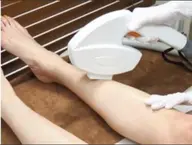 【女性全員】全身光脱毛(VIO込/お顔なし)