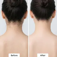 【シェービング】背中美人になる産毛ケア|背中パック付き¥5,000 → ¥3,000