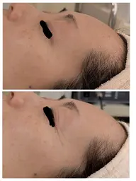 50代に人気！[ハリと弾力のあるツヤ肌に♪]たるみ・しわ改善コース2回体験　[大阪城北詰/京橋駅]