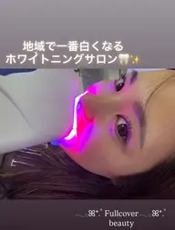【初回限定✨】痛みなし！自然な白さへ🦷セルフホワイトニング（30分照射）