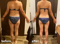 【筋膜リリース🦾全身60分¥5500】巻き方・腰痛・セルライト・ブラのハミ肉…一つでも気になる方は是非❤️‍🔥