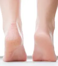 フットケアコース🦋🫧【地爪の方限定】角質ケア&ウォーターケア付き