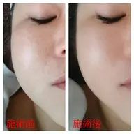 🕊細胞整う　超音波トリートメント🕊