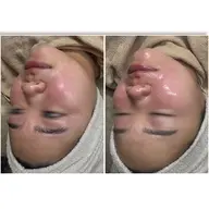 大人気‼️お肌も眉もお手入れ💆‍♀️【艶肌wax】+【ハリウッドブロウリフト】が同日にできるセットメニューです。