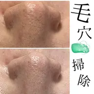 【モニター大募集！】毛穴のお掃除をさせてください！60分毛穴掃除コース！今だけ限定！¥9900→¥5500