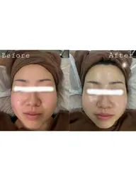 ✨【透明感UP美肌】シミ・くすみ・たるみ改善フェイシャルコース✨