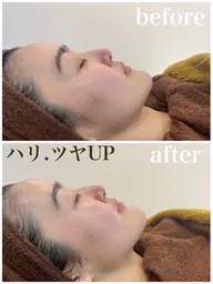 【EMS×導入ケア】ハリ・ツヤ感を目指す✨スペシャルフェイシャル（毛穴洗浄付）