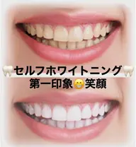 🦷10分照射✖️2回を3回分‼️初回来店日から2ヶ月有効！¥26,400→¥9,900