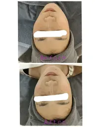 美肌エイジングケアコース