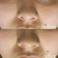 お肌に透明感を♪くすみに◎小顔コルギ+頭蓋骨調整&石膏パック 110分コース