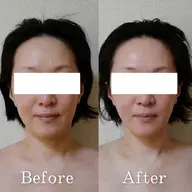 小顔矯正コースしっかり65分