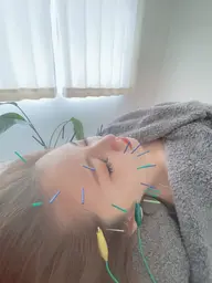 《初めての方限定!!✨》スタンダート美容鍼コース60分🌼