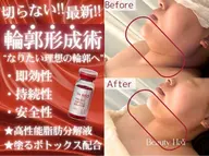 ミニモ学割U24【次世代レモン🍋ボトル｜切らない輪郭形成】フェイスライン・顎下・小顔ケア｜脂肪溶かい液レッドショット