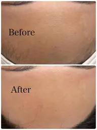 ツルツル美肌✨フェイシャルワックス(全顔)