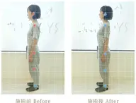 整体コース(首、肩、腰がつらい方、姿勢が悪くカラダの歪みが気になる方、朝起きても疲れがとれていない方にオススメ)