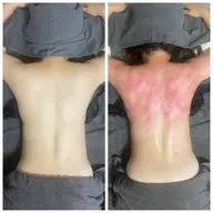 ミニモ限定カッピング痩身全身30分➕ヒートマット付き