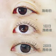 まつ育パーマ マイラミネーション(上)