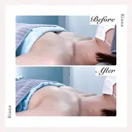 【2回目限定】バストオーダーメイド施術 80分